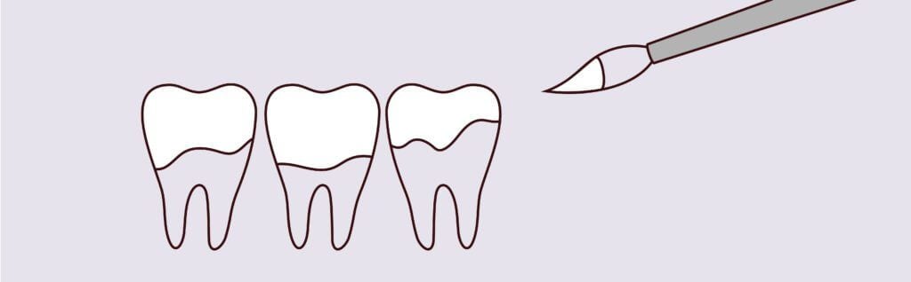 Yerra Family Dentistry - Woodinville Dentist Yerra Family Dentistry - Woodinville Dentist