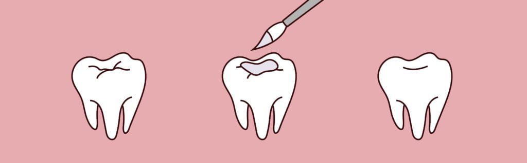 Yerra Family Dentistry - Woodinville Dentist Yerra Family Dentistry - Woodinville Dentist